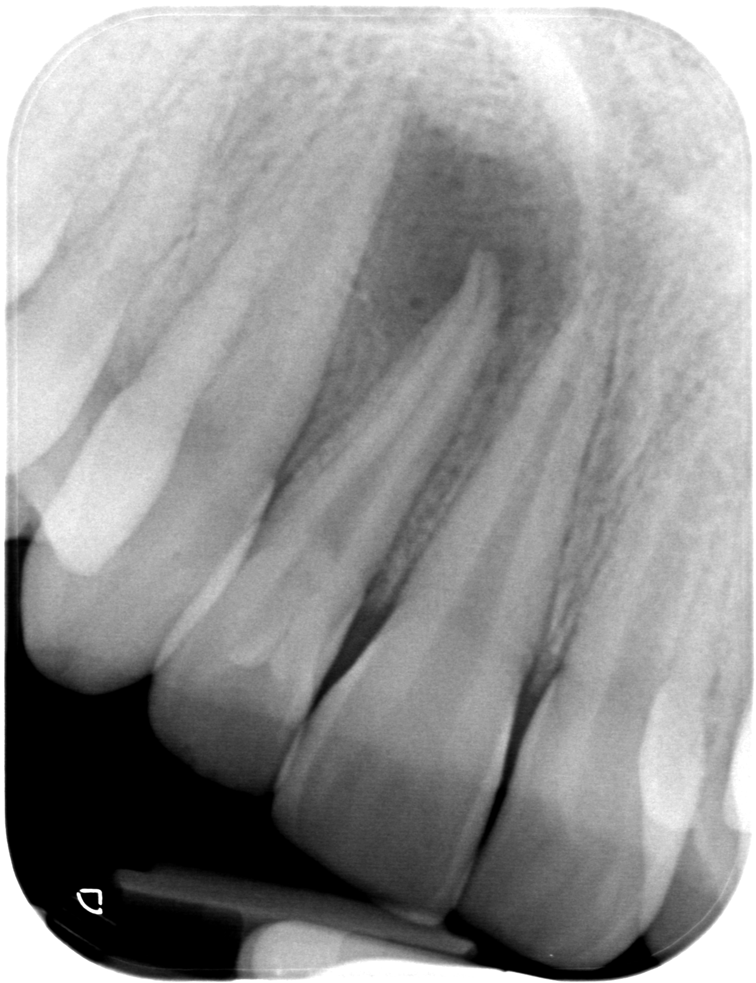 BL-X-20160407-180743-XAEK4FBDR3ZB-4