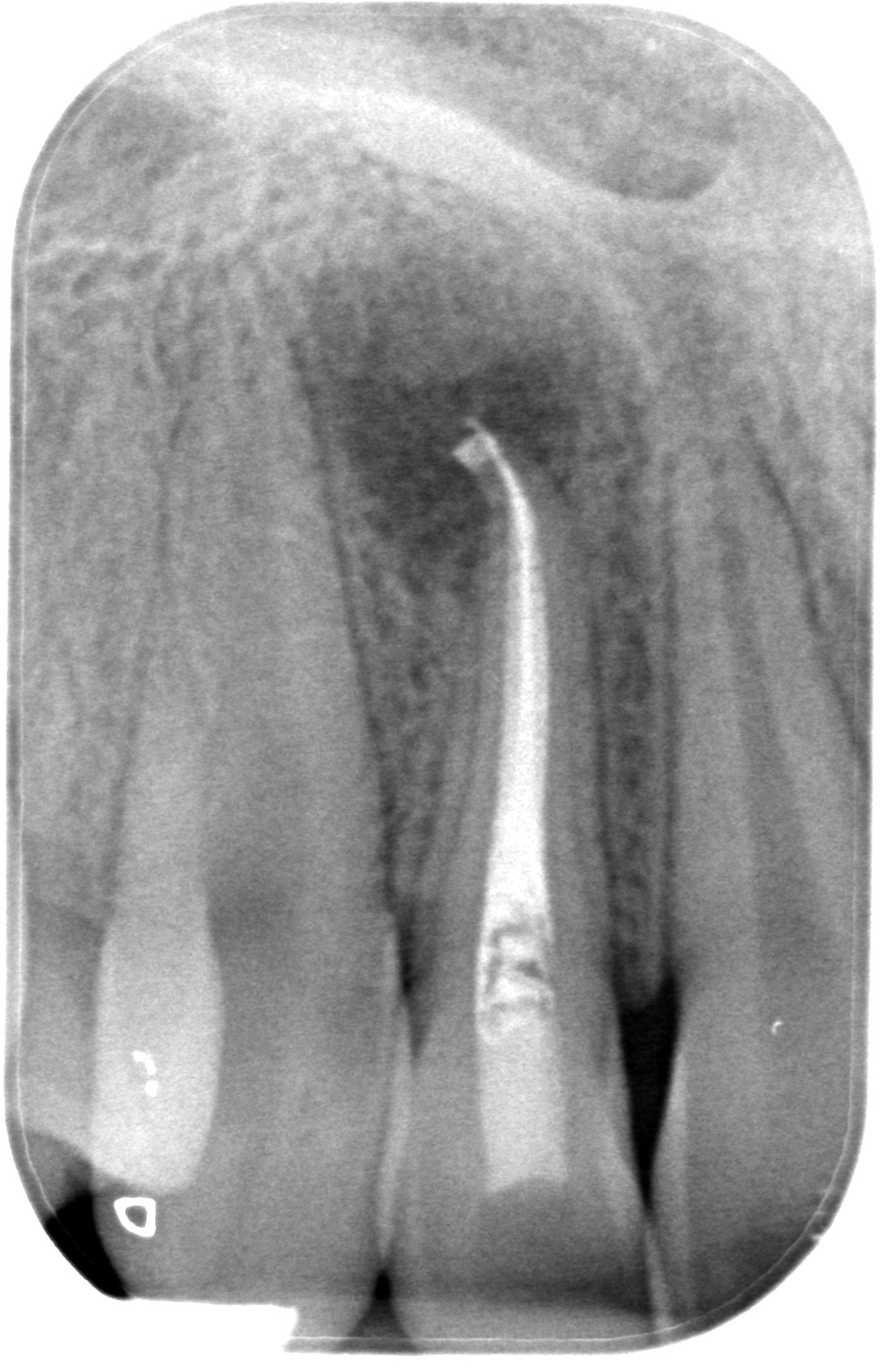 BL-X-20160914-150158-XLHX1WAWOKO-4