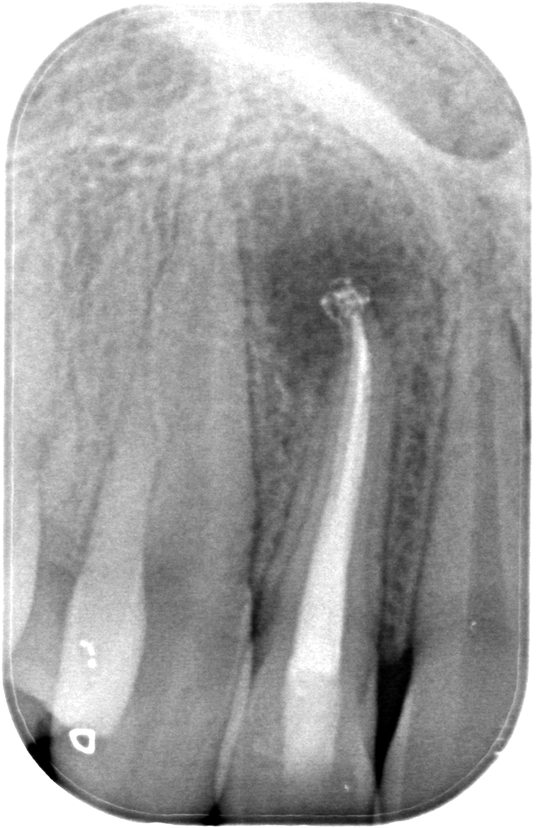 BL-X-20160915-155453-XVYCBA+Q6+GI-4