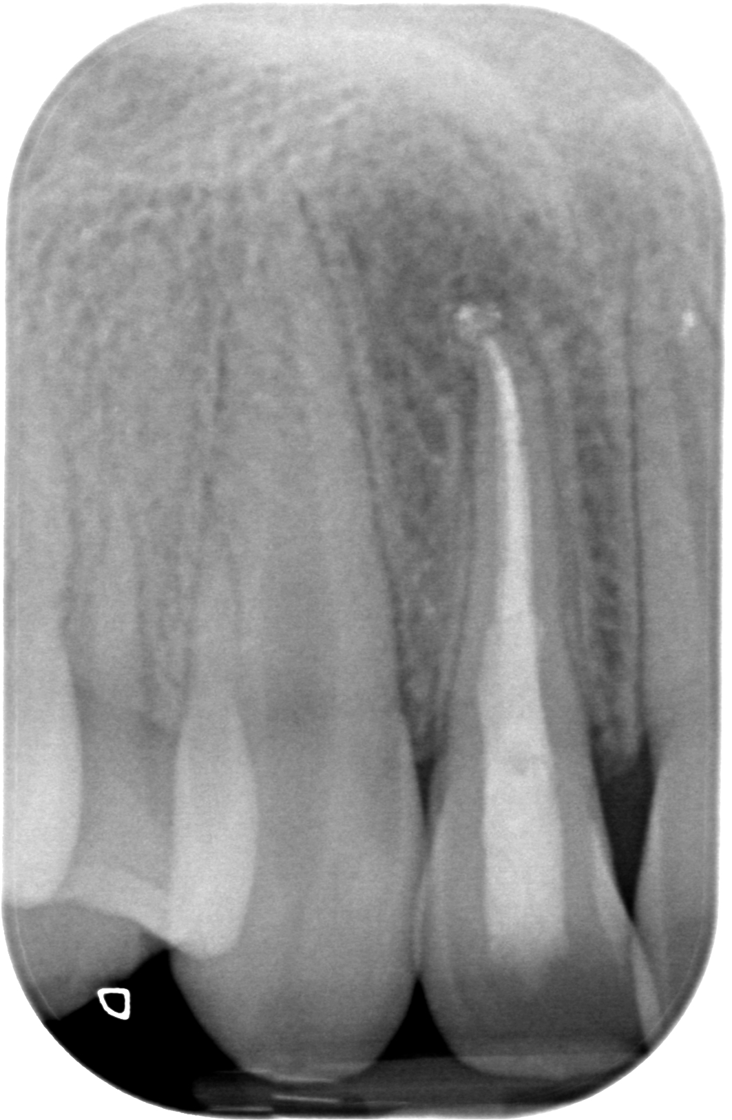 BL-X-20170412-155630-XT1VMOBEIZTK-4