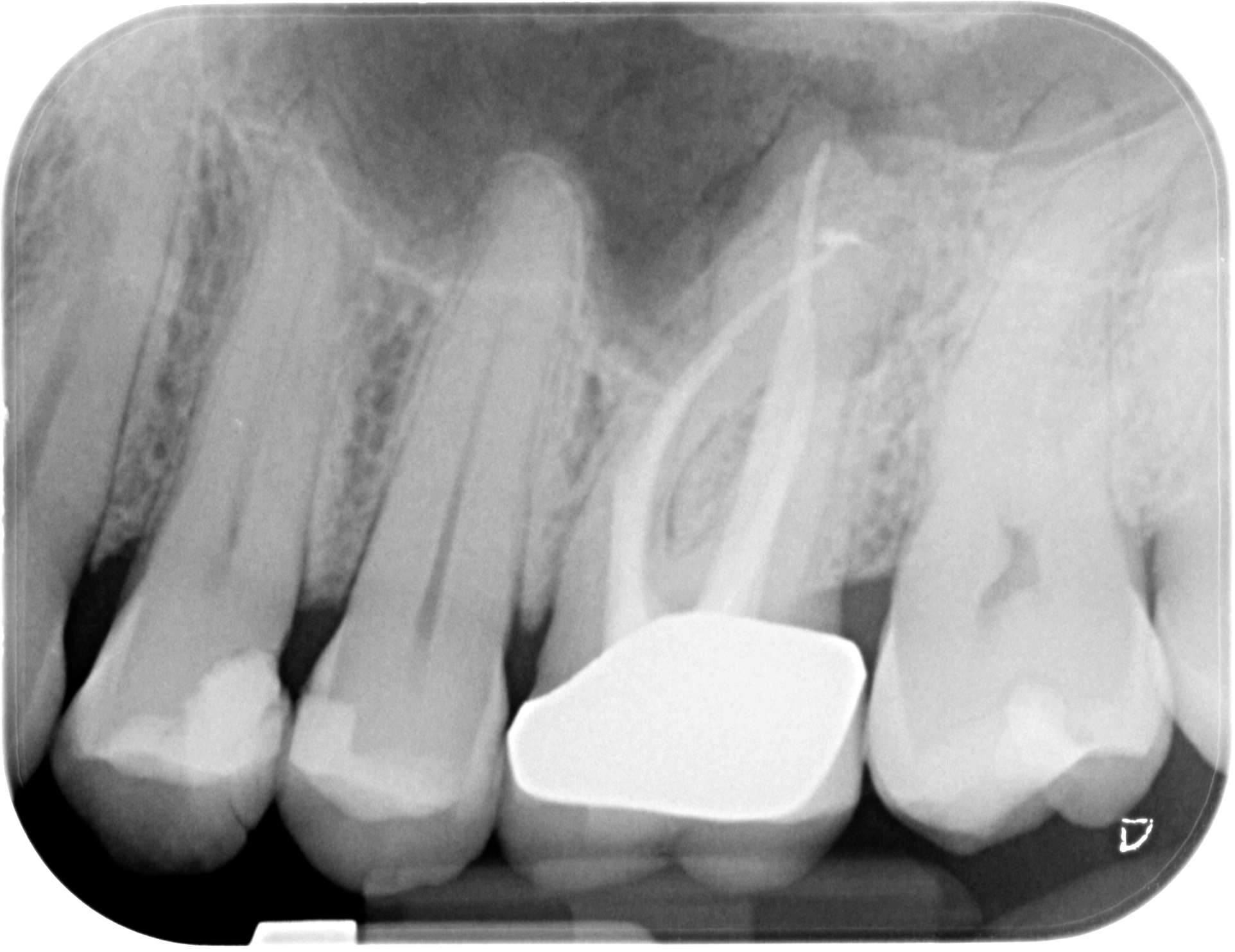 WD26-X-20210325-110343-XCYQLFVFPOAO-4